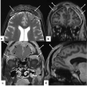 Fig. 14