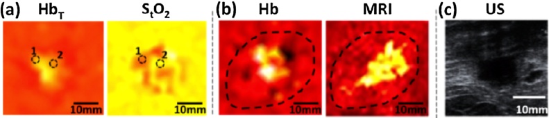 Fig. 15