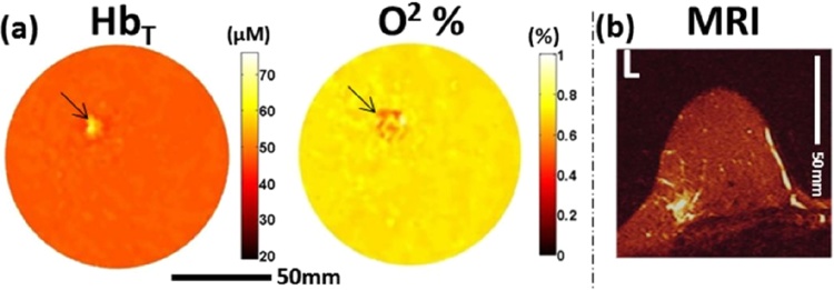 Fig. 14