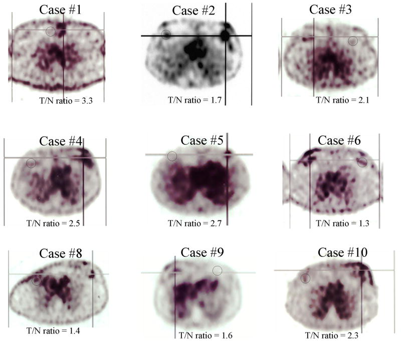 FIGURE 3