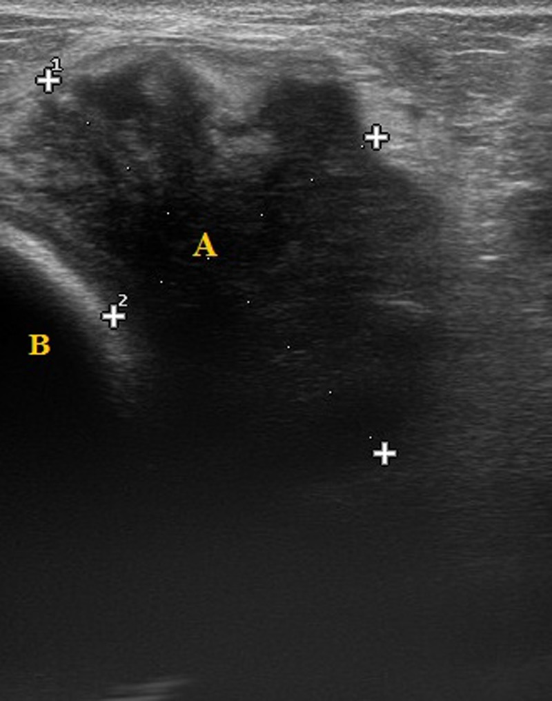 Figure 2