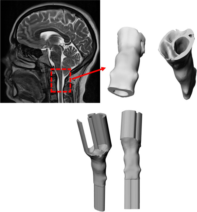Fig. 1