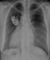 Figure 5
