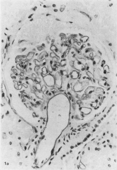 Fig. 1a