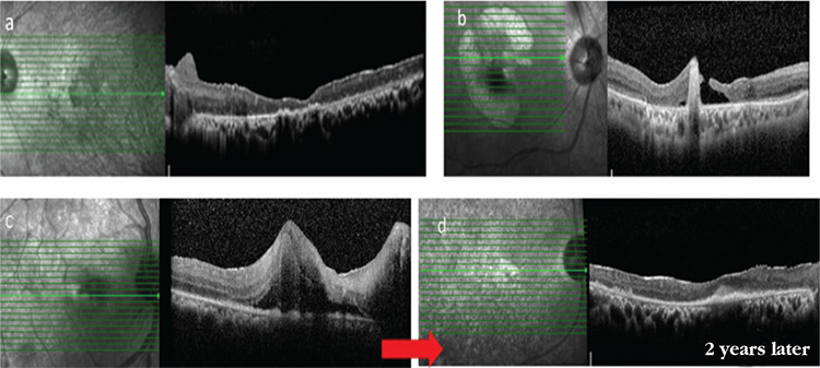 Figure 16