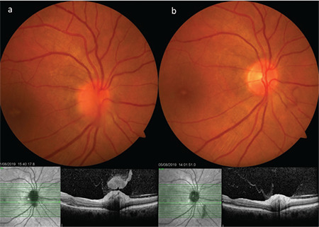 Figure 18