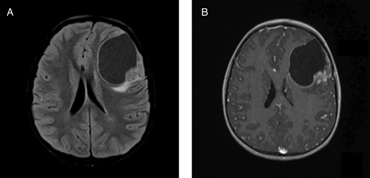 Fig. 2.