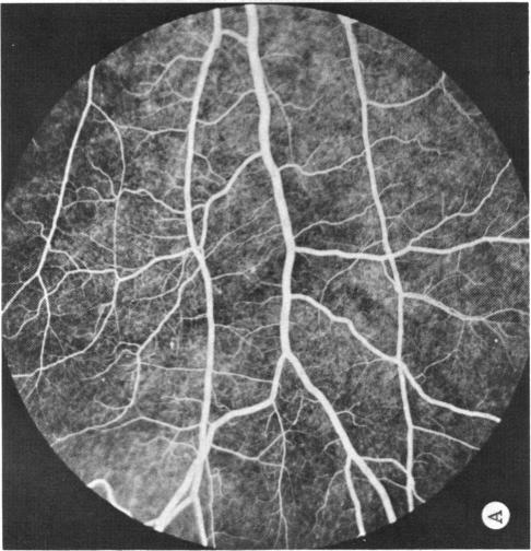 FIGURE 13 A