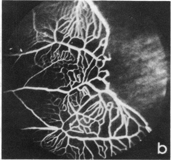 FIGURE 12 b