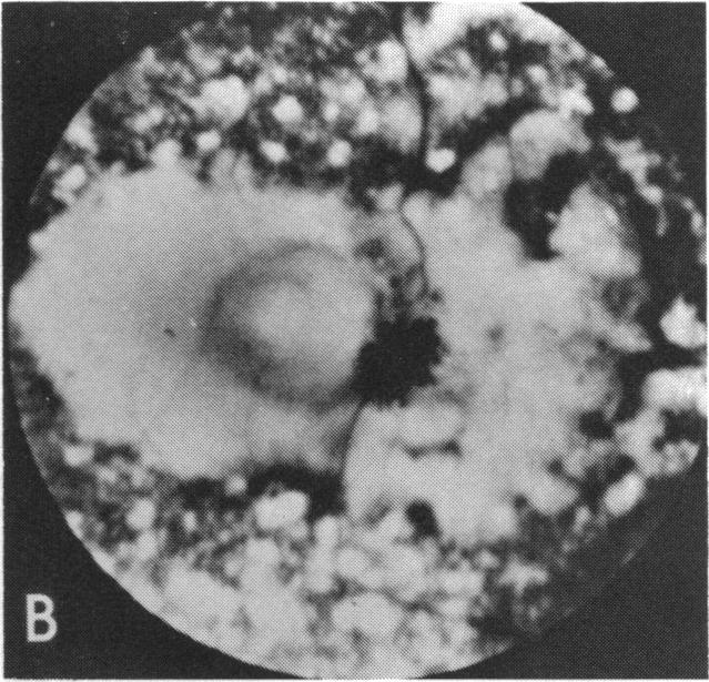 FIGURE 8 B