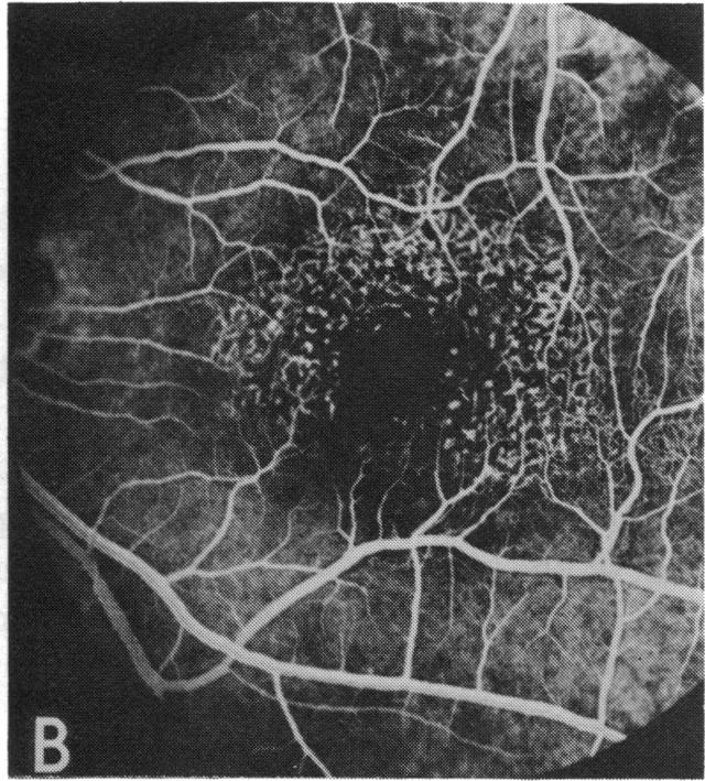 FIGURE 10 B