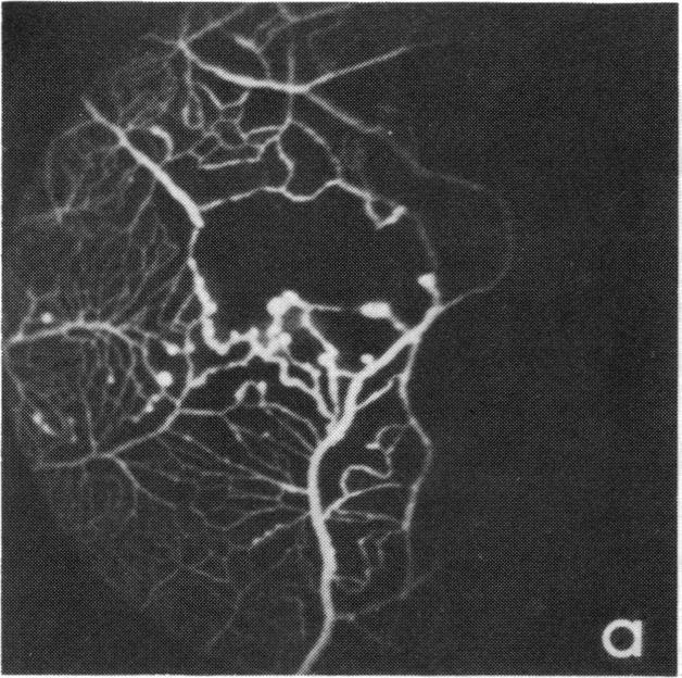 FIGURE 12 a