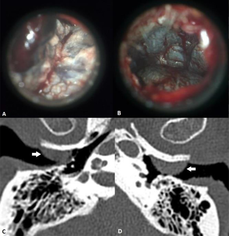 Fig 1 –