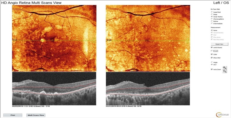 Fig. 11