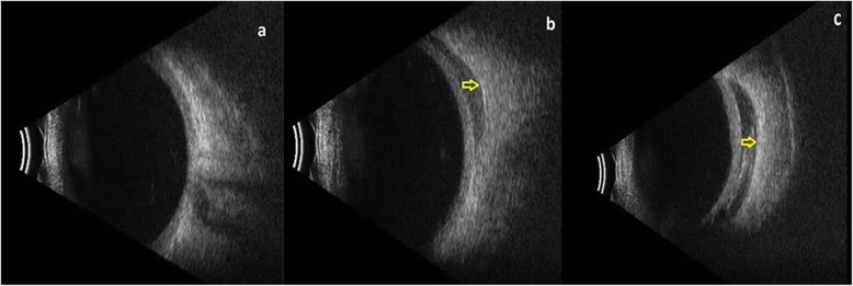 Fig. 8