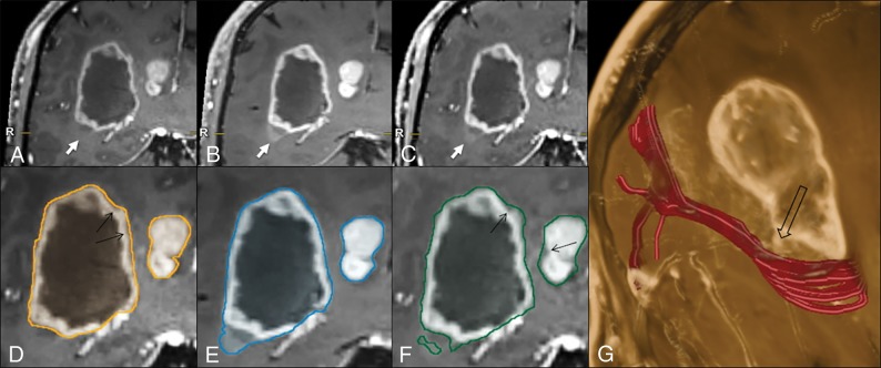 Fig 3.