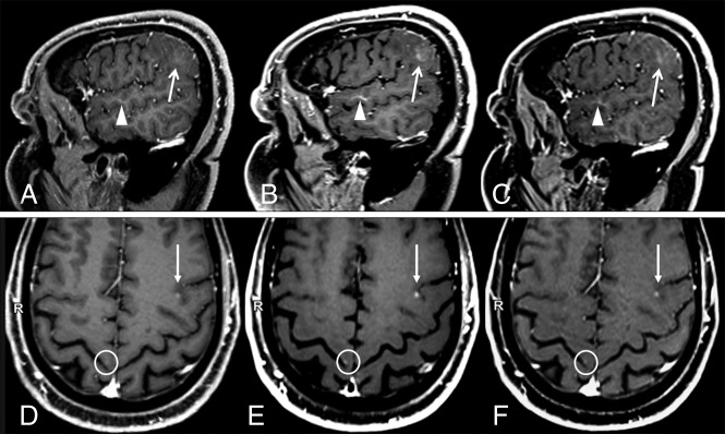 Fig 2.