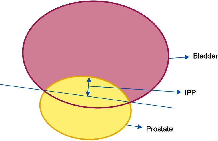 FIG. 1