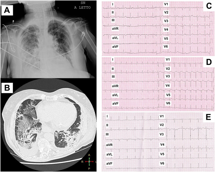 FIGURE 1