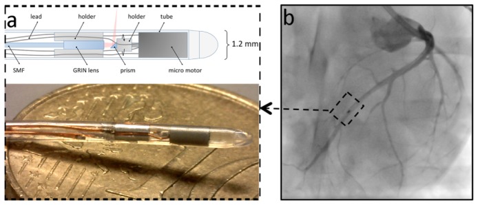 Fig. 1