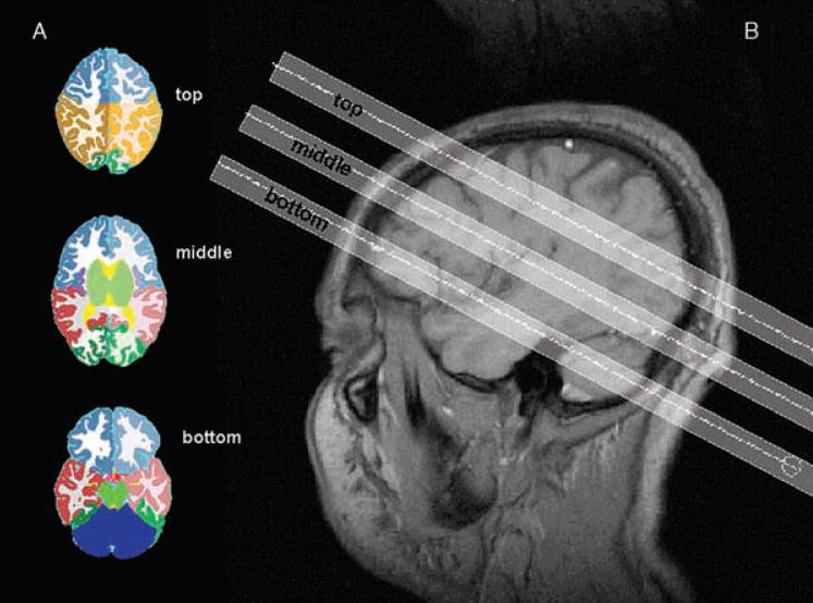 FIG. 1