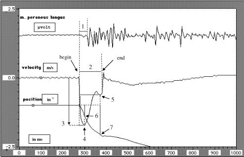 Variables of the sudden inversion in the standing position. A downward course of the velocity graph indicates an increase of inversion speed; an upward course indicates a decrease of inversion speed. 1 = latency time of the peroneus longus muscle (milliseconds), 2 = total inversion time (milliseconds), 3 = maximum inversion speed (m/s), 4 = time of the first deceleration (milliseconds), 5 = time of the second deceleration (milliseconds), 6 = angular position of the first deceleration (°), and 7 = angular position of the second deceleration (°).