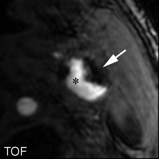 Figure 4a: