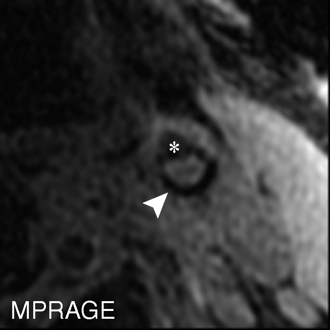 Figure 6c: