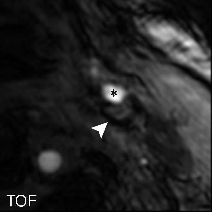 Figure 6a: