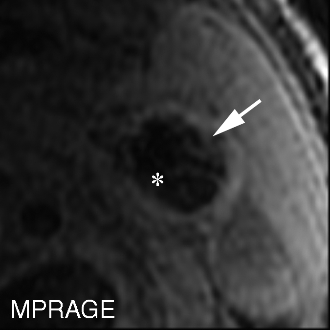 Figure 4c: