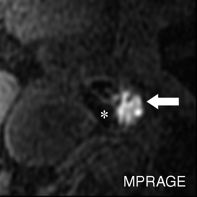 Figure 3c: