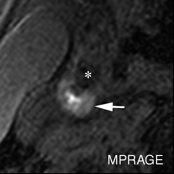 Figure 2c: