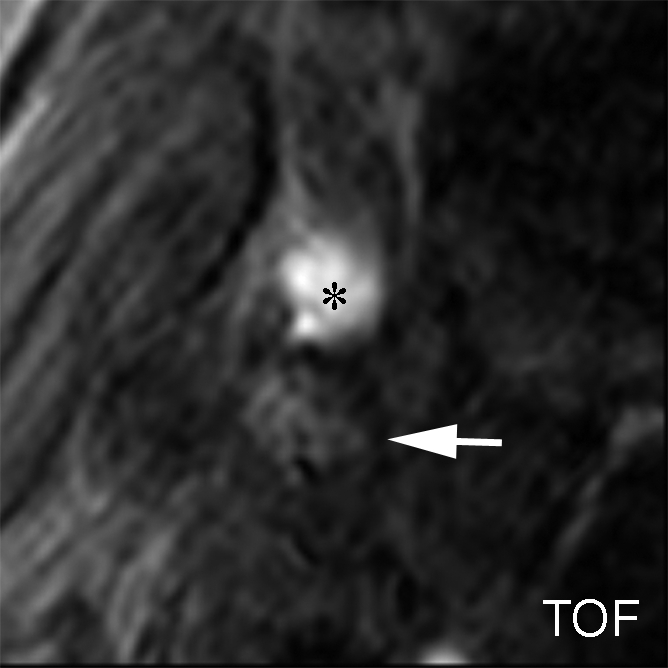 Figure 2a: