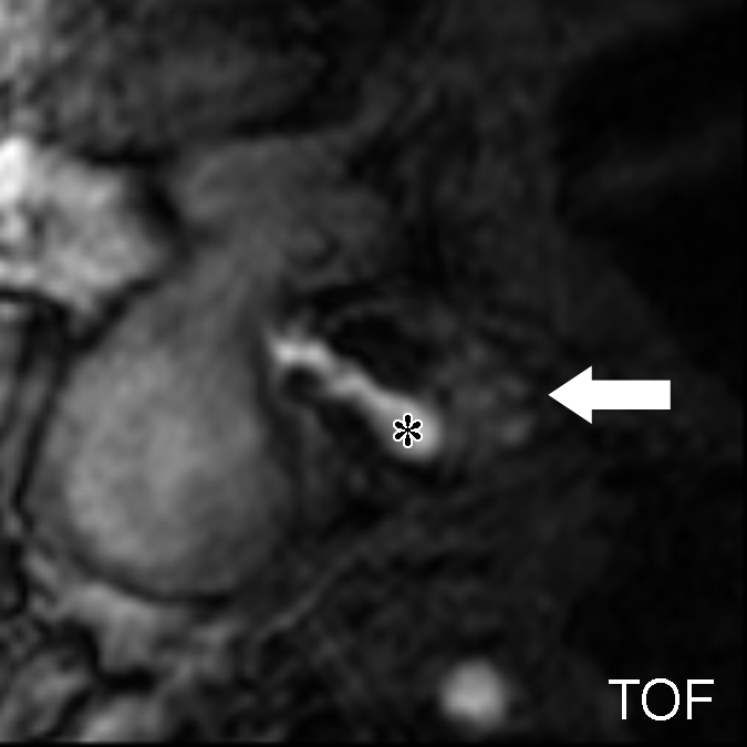 Figure 3a: