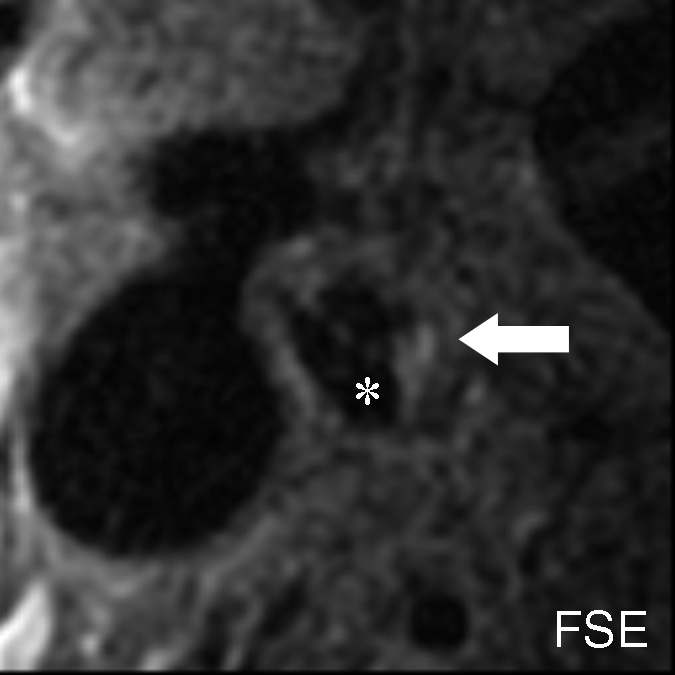 Figure 3b: