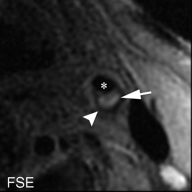 Figure 6b: