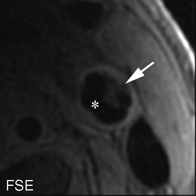 Figure 4b: