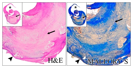 Figure 6d: