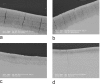 Fig. (1)