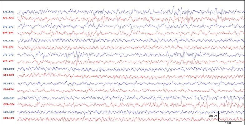 Fig. 7