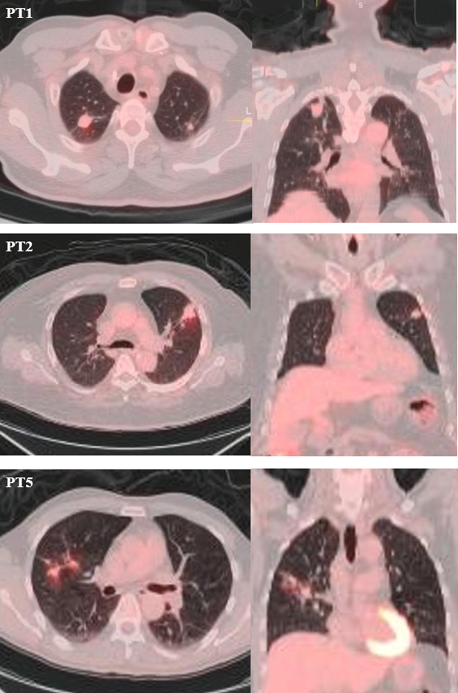 Fig. 1