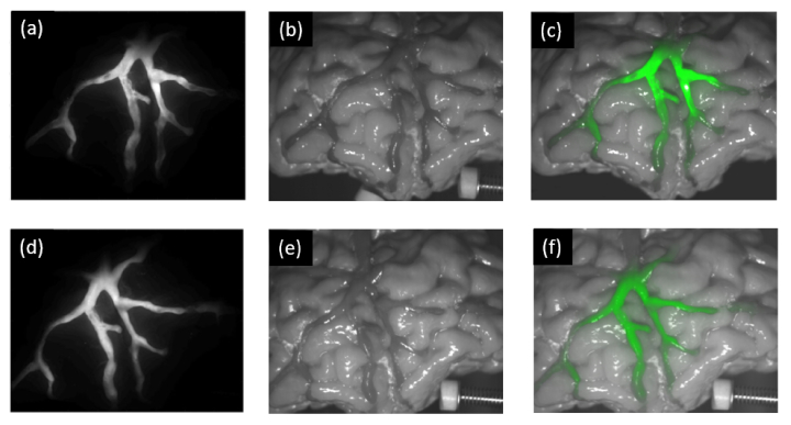 Fig. 10