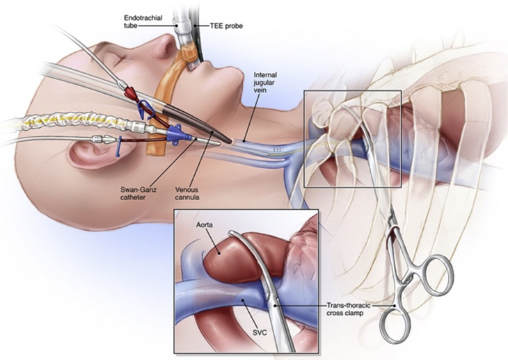 Figure 2