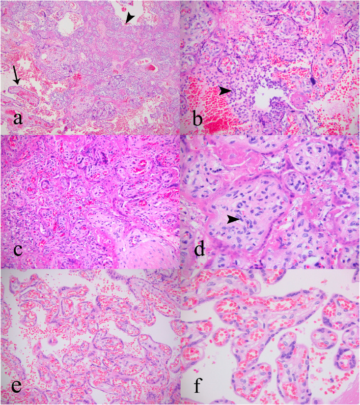 Fig. 2