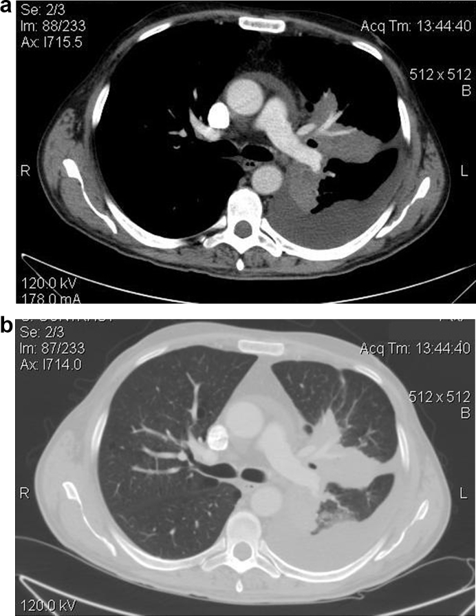 Fig. 1