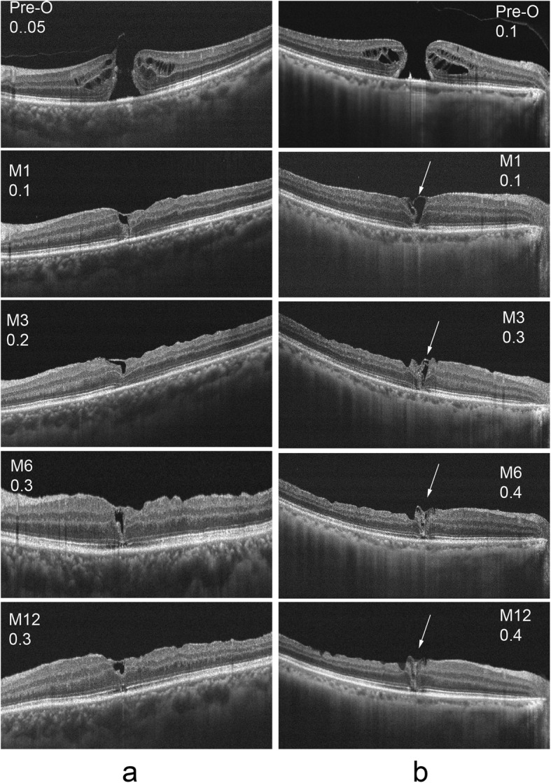 Fig. 4