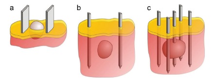 Fig. (18)