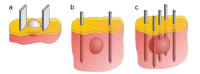 Fig. (18)