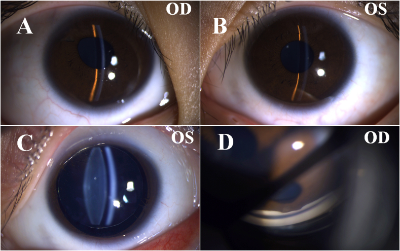 Fig. 1