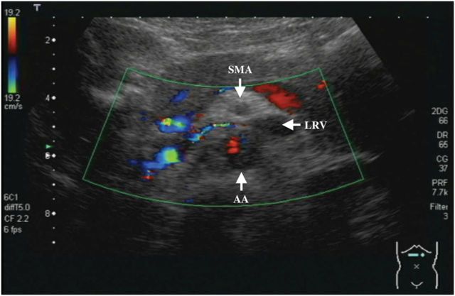 Fig. 2.